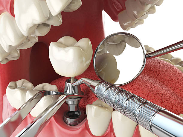 Best Tooth Pain Emergency Relief  in Perry, OK